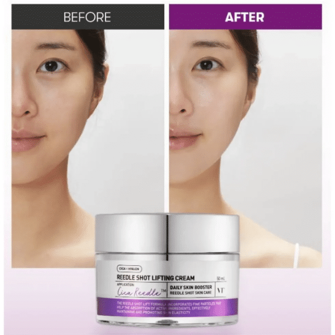 Reedle Shot Lifting Cream – Κρέμα Σύσφιξης & Αντιγήρανσης