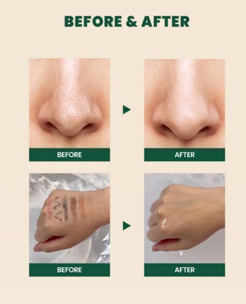 SEOUL 1988 Cleansing Oil : Pine Cica 1% + Probiotics - Έλαιο καθαρισμού και ντεμακιγιάζ