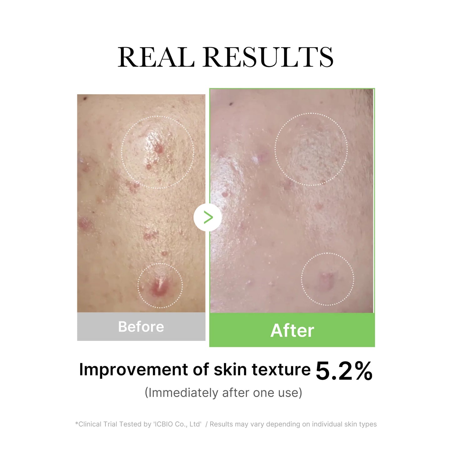 Exosome Cica Ampoule – Ενισχυμένος Ορός Καταπράυνσης & Ενυδάτωσης