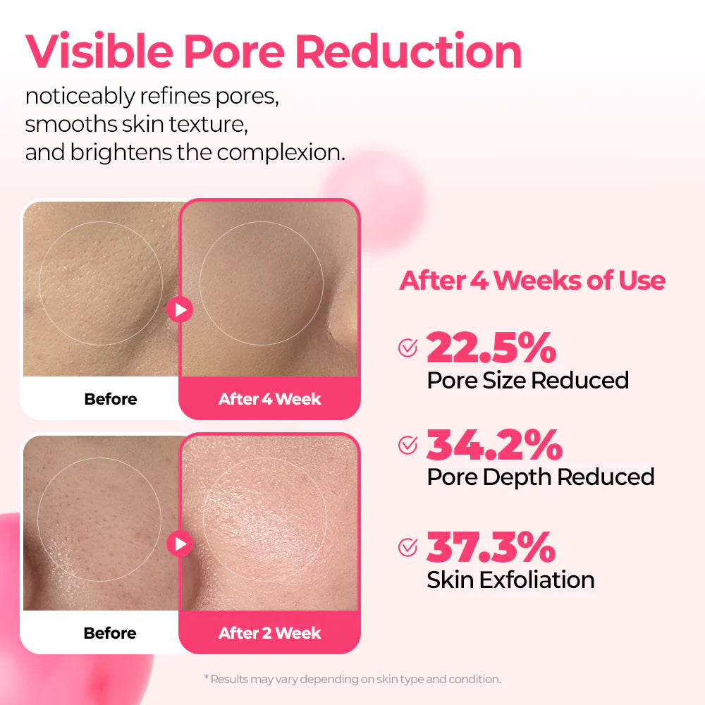 Cemenrete Cyano Pink Spicule Serum - Ροζ Σερουμ Αναγέννησης με Βιταμίνη B12