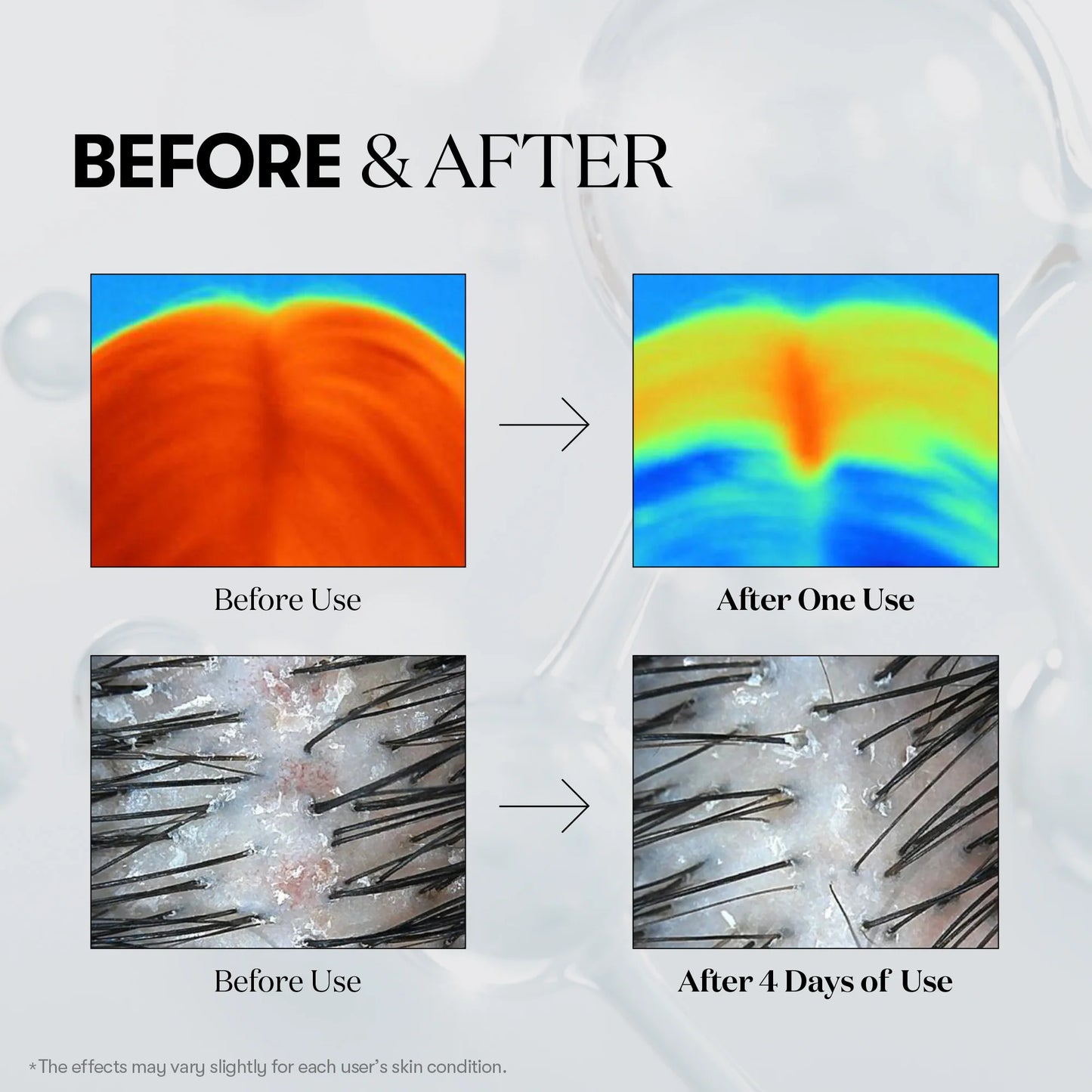 Reedle Shot Hair Ampoule 100dL - Ενισχυτικός Ορός Κατά της Τριχόπτωσης