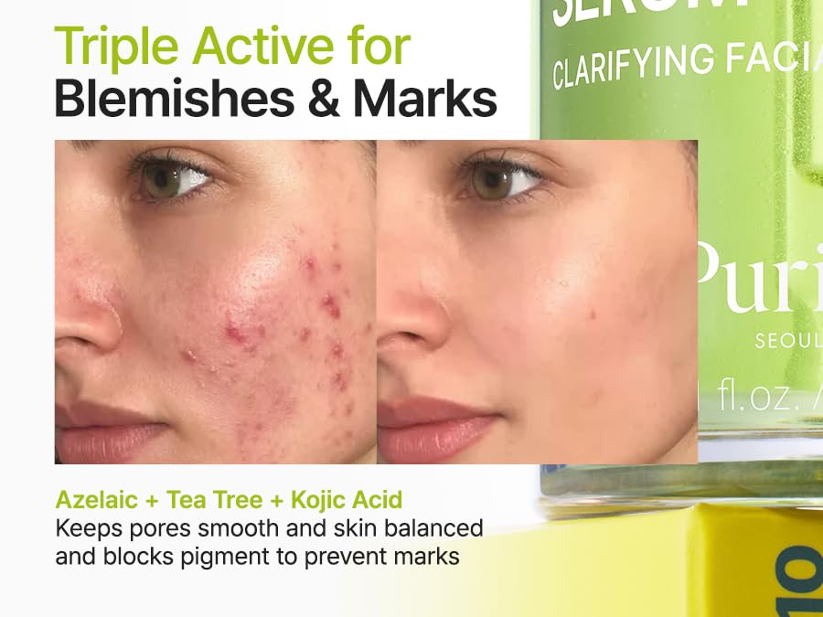 Azelaic Acid 10 Kojic Tea Tree Serum