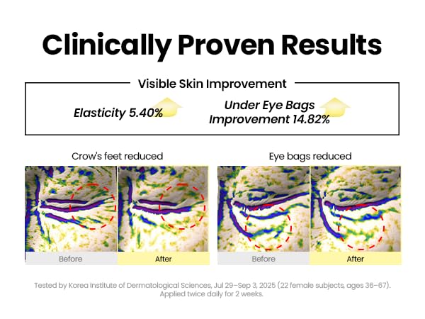 SEOUL 1988 Eye Cream: Retinal Liposome 4% + Fermented Bean - Αντιρυτιδική κρέμα ματιών με Ρετινάλη