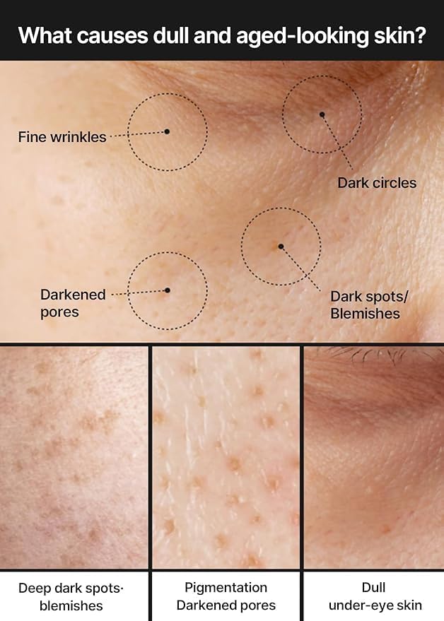 Pore+Dark Spot Brightening Cream - Κρέμα Λάμψης & Διόρθωσης Κηλίδων