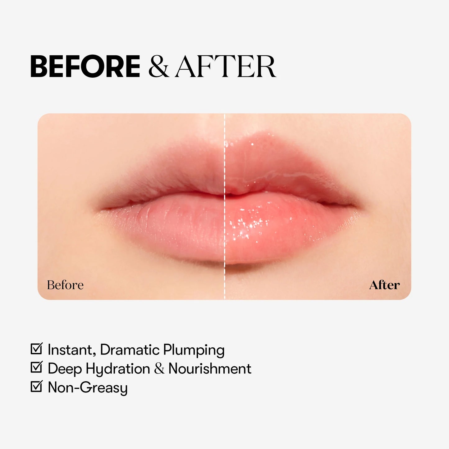 Reedle Shot Lip Plumper Expert – Ισχυρό Διογκωτικό Gloss με μικροβελόνες