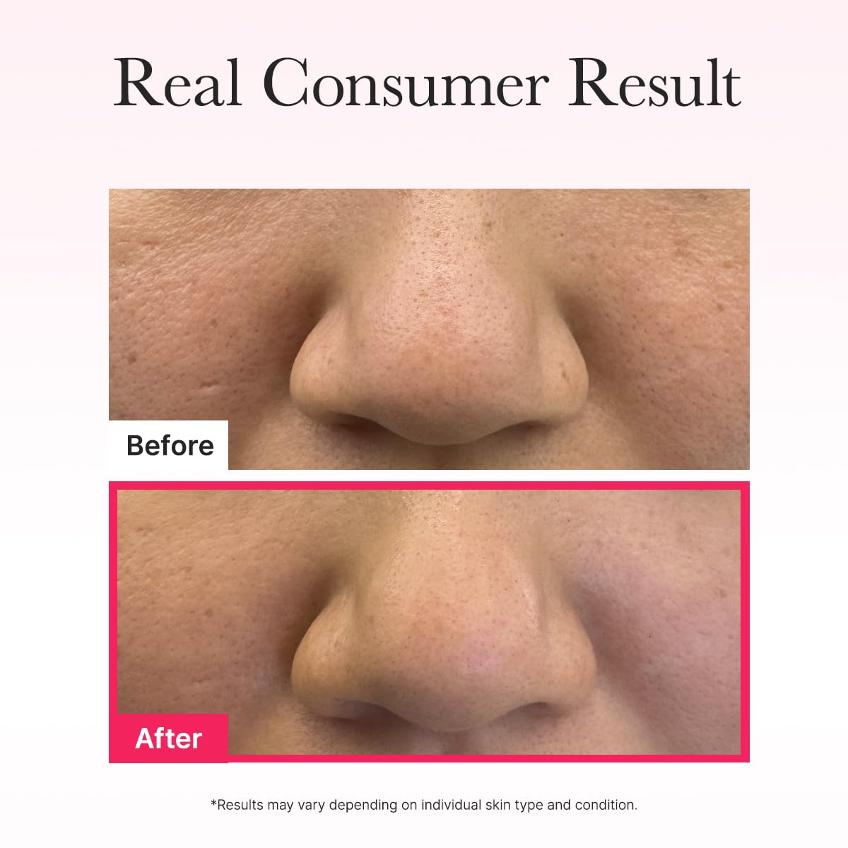 Red Collagen Jello Mask - Μάσκα Σύσφιξης & Εντατικής Αναζωογόνησης