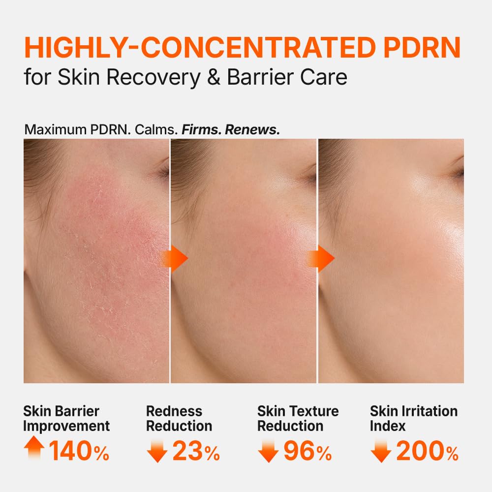 PDRN 3% Hyper Boost Ampoule -  Αμπούλα Υψηλής Συγκέντρωσης PDRN για Εντατική Ανάπλαση, Ενυδάτωση & Ενίσχυση του Δερματικού Φραγμού
