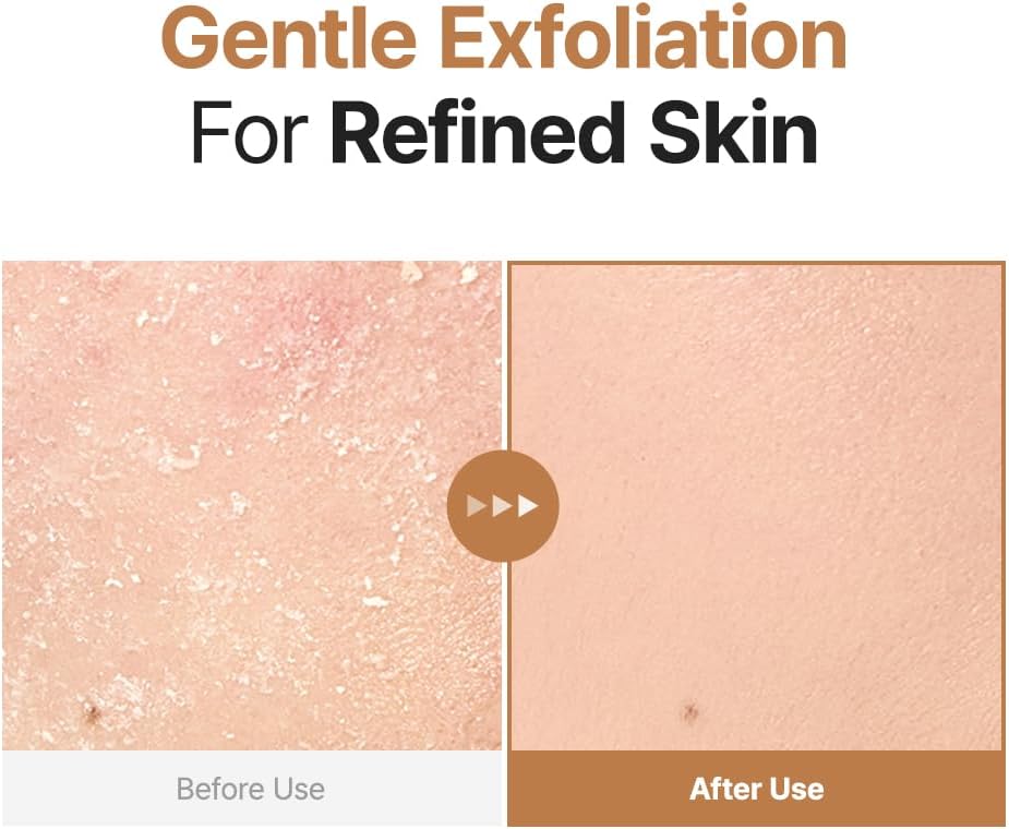 Oat PDRN Gentle Refining Toner - Καταπραϋντικός Τονωτικός Ορός Βρώμης