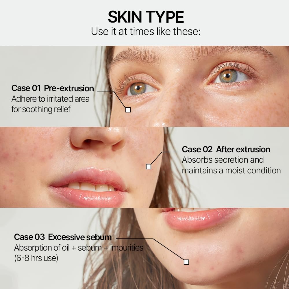 Cicamanu Clear Patch - Καταπραϋντικά Patches Ακμής με Cica & Manuka Honey