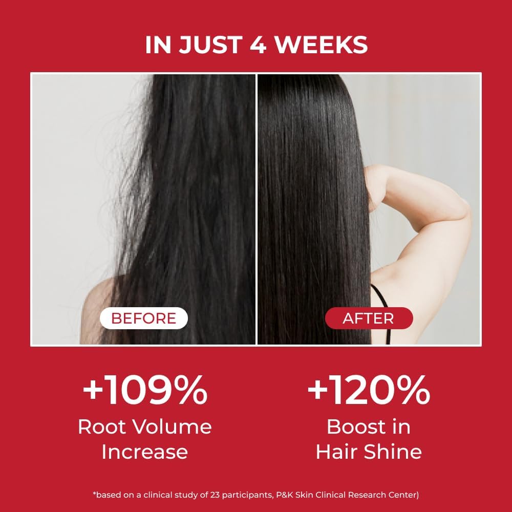 Annurcatin Shampoo – Σαμπουάν Ενδυνάμωσης & Όγκου για Αδύναμα Μαλλιά