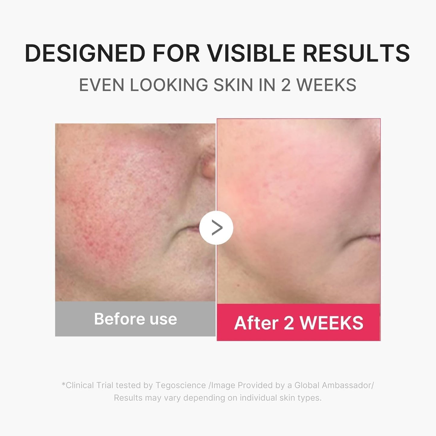 AGE-R Booster Pro Mini Plus Pink