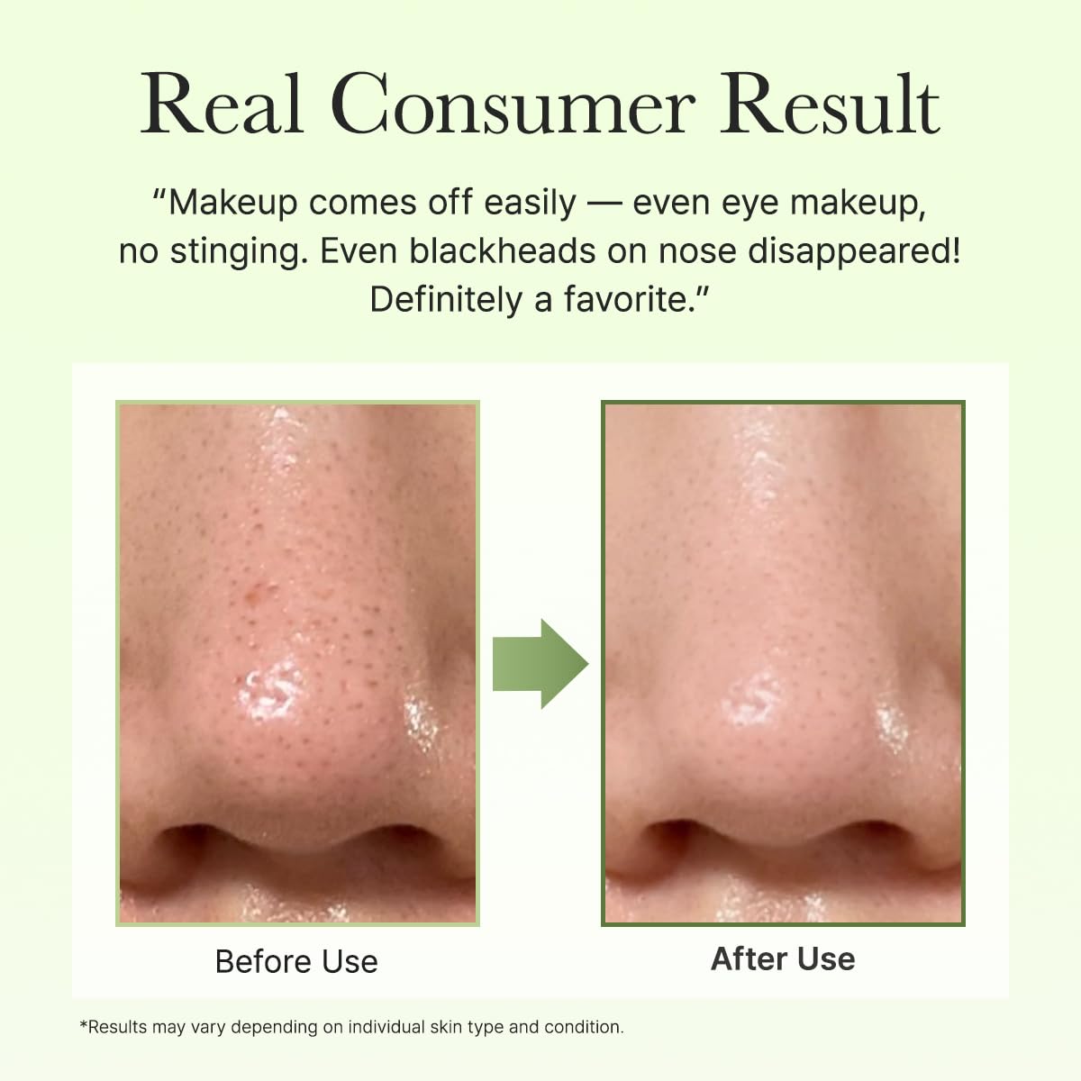 Pore Melt Phyto PDRN Cleansing Balm - Καθαριστικό Balm Ντεμακιγιάζ για Βαθύ Καθαρισμό Πόρων