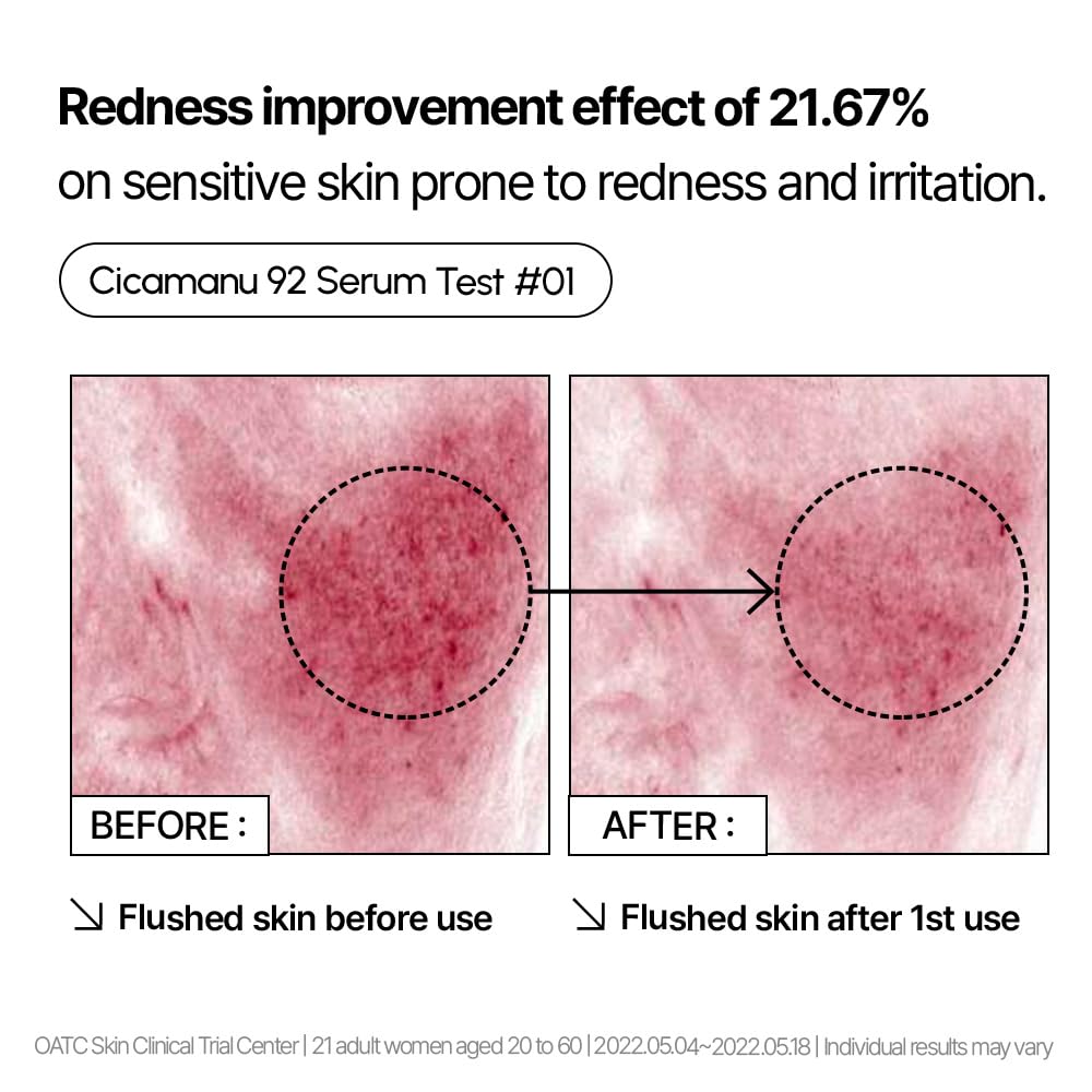 Cicamanu 92 Serum - Ορός Επανόρθωσης & Καταπράυνσης