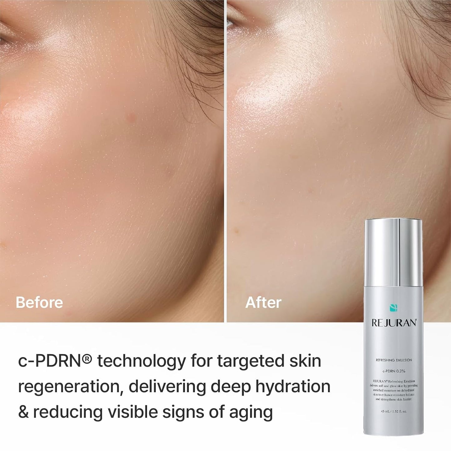Refreshing Emulsion – Ενυδατικό Γαλάκτωμα Προσώπου με c-PDRN