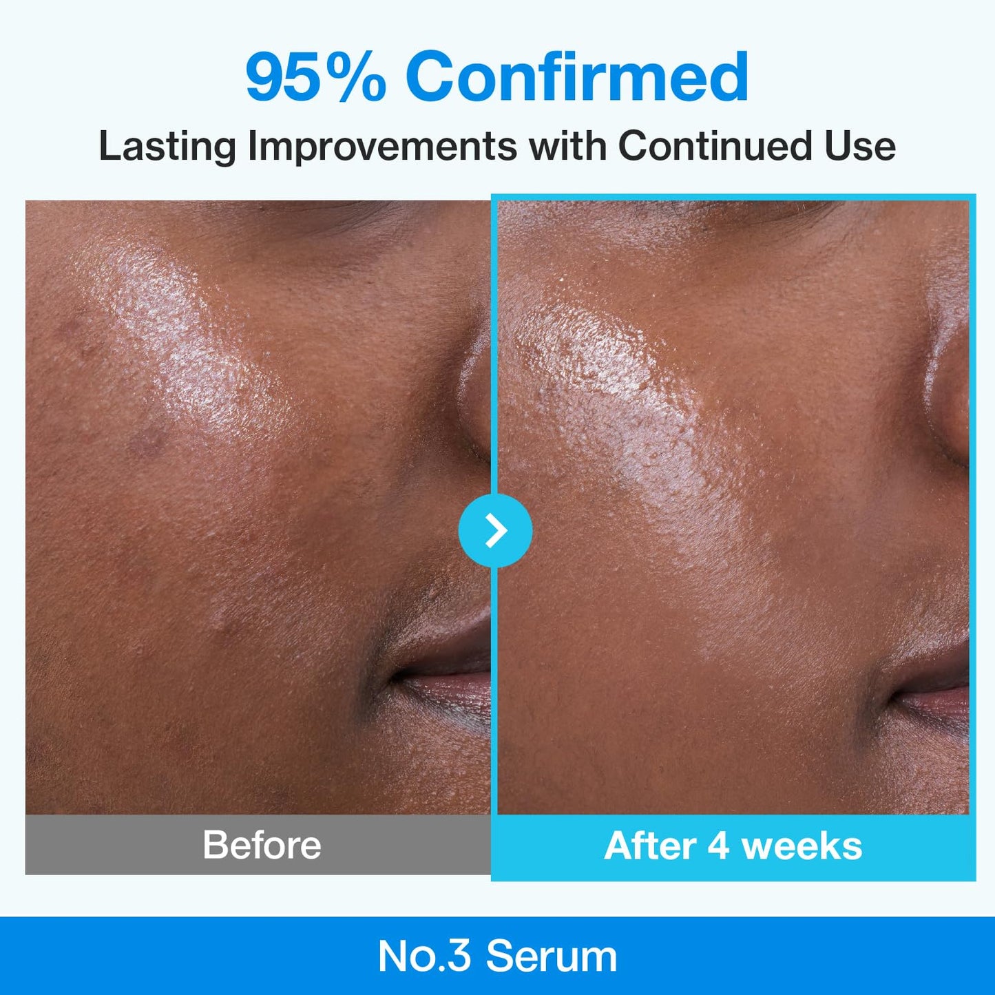 No.3 Blue Bio-Retinol Pore Refining Serum – Ορός Προσώπου με Bio-Retinol & 10% Νιασιναμίδη για Πόρους και Υφή