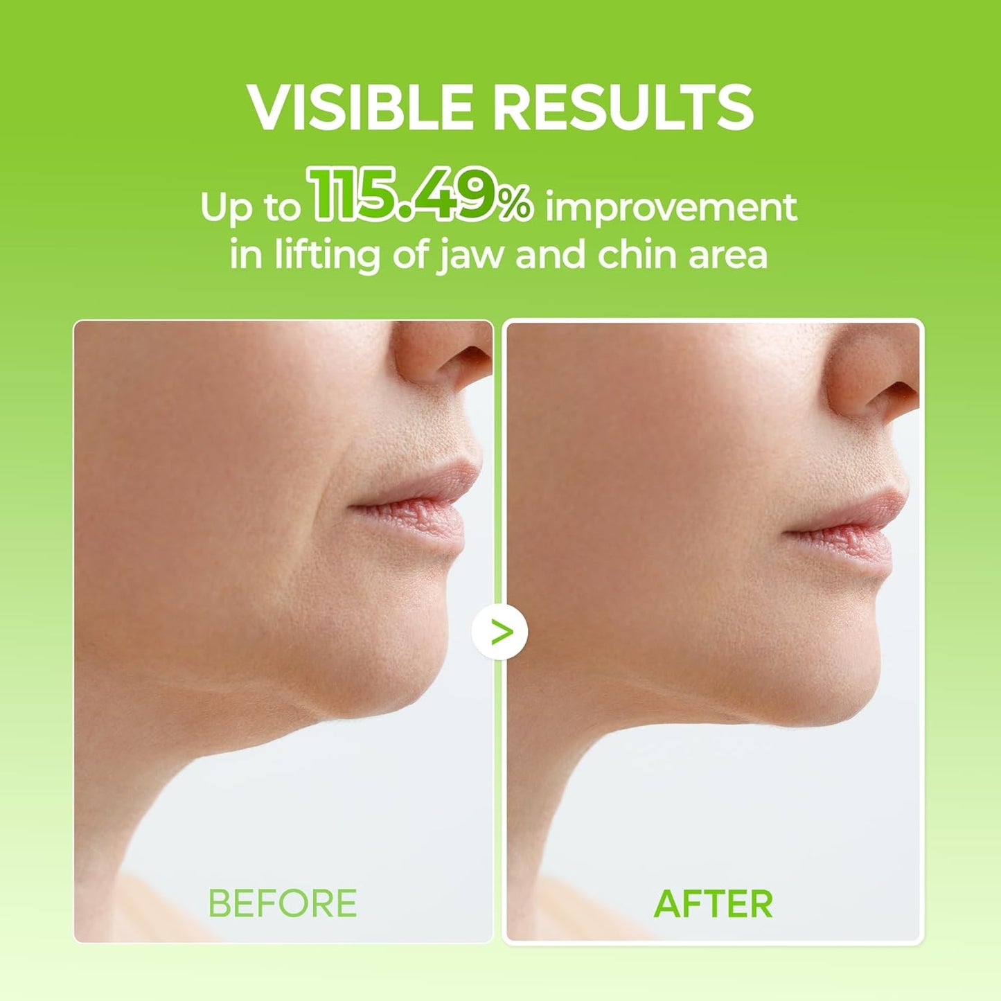 Cactox Cooling V-UP Mask - Μάσκα Ανόρθωσης V-Line για Σύσφιξη & Καθορισμό Περιγράμματος