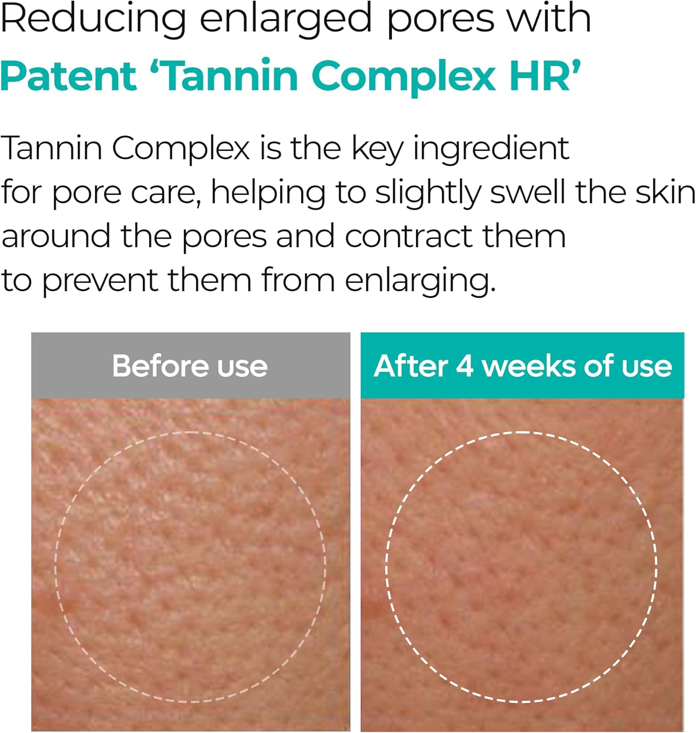 BP Pore Clear Facial Mask - Μάσκα με Μικροβελόνες & Νιασιναμίδη για βαθύ καθαρισμό