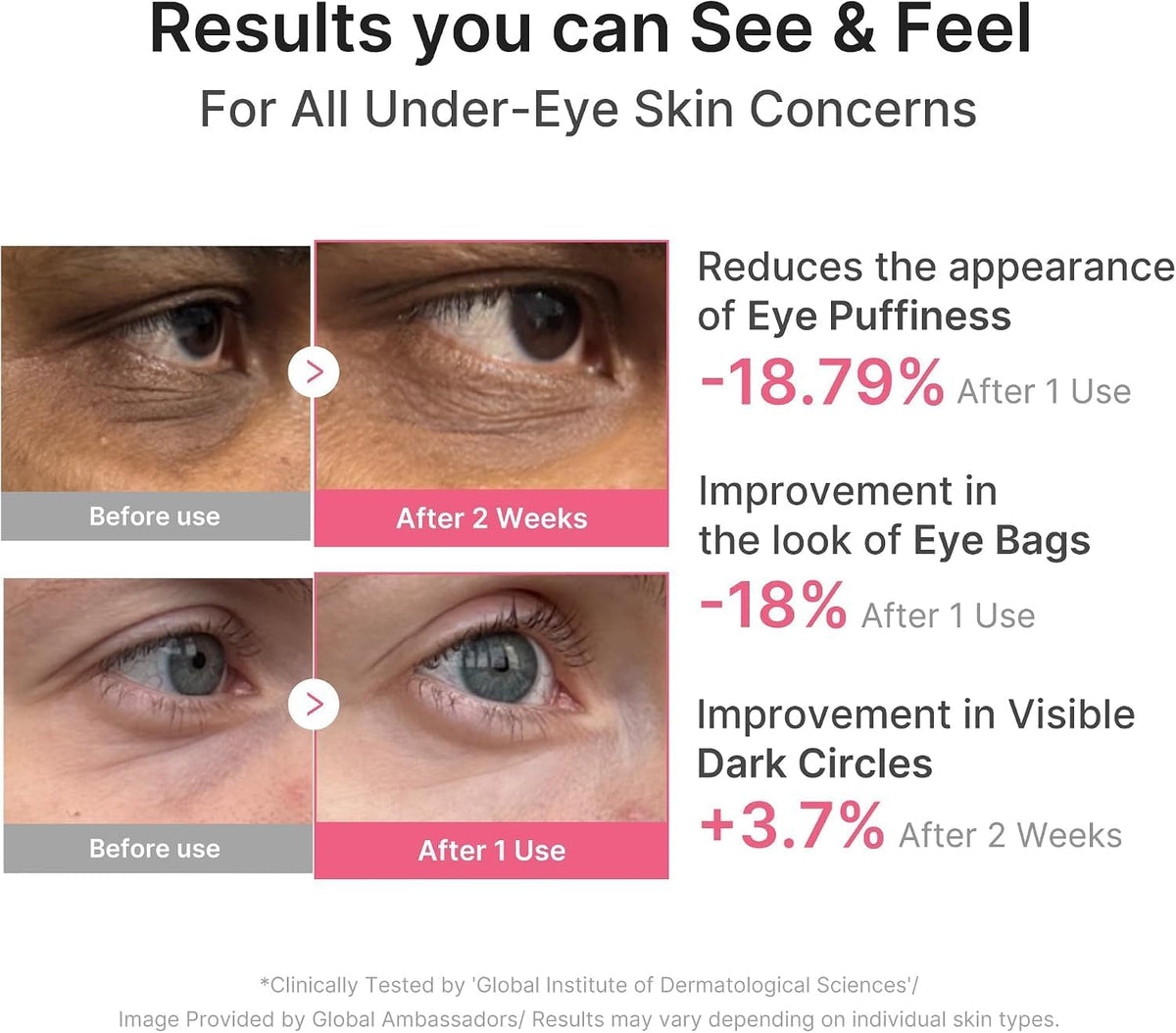 PDRN Pink Caffeine Collagen Eye Patch – Hydrogel Patches Ματιών με PDRN, Καφεΐνη & Κολλαγόνο για Σύσφιξη & Αναζωογόνηση