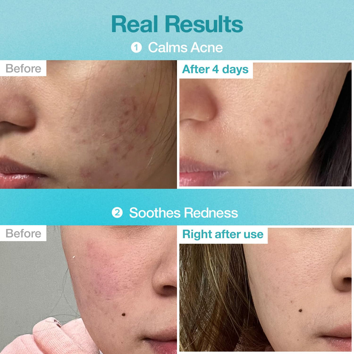 No.1 Pantothenic B5 Hyaluronic Active Clear Mask