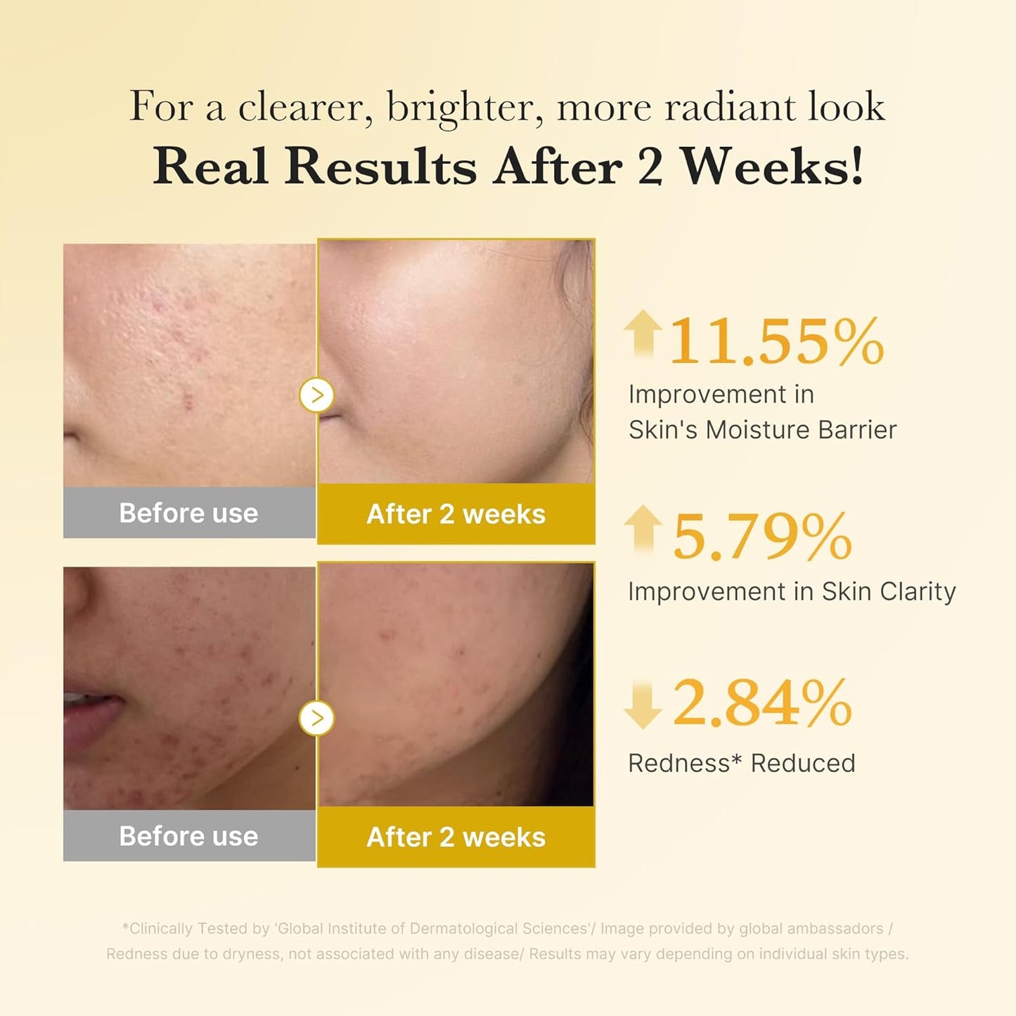 Kojic Acid Turmeric Niacinamide Serum - Ορός Προσώπου για Λάμψη, Ομοιόμορφο Τόνο και Ενυδάτωση