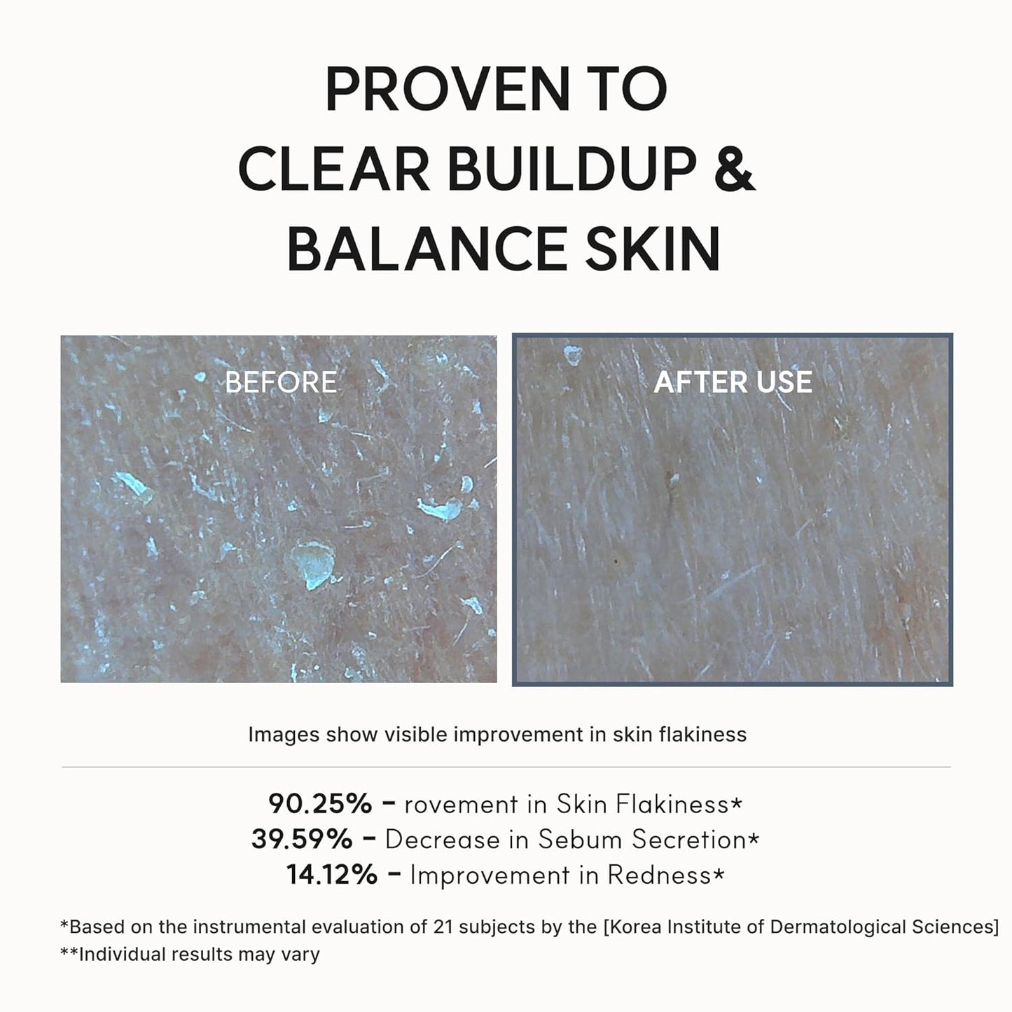 Eraser Shot Glycolic Acid Booster - Booster Απολέπισης με Γλυκολικό Οξύ για Πόρους & Ατέλειες