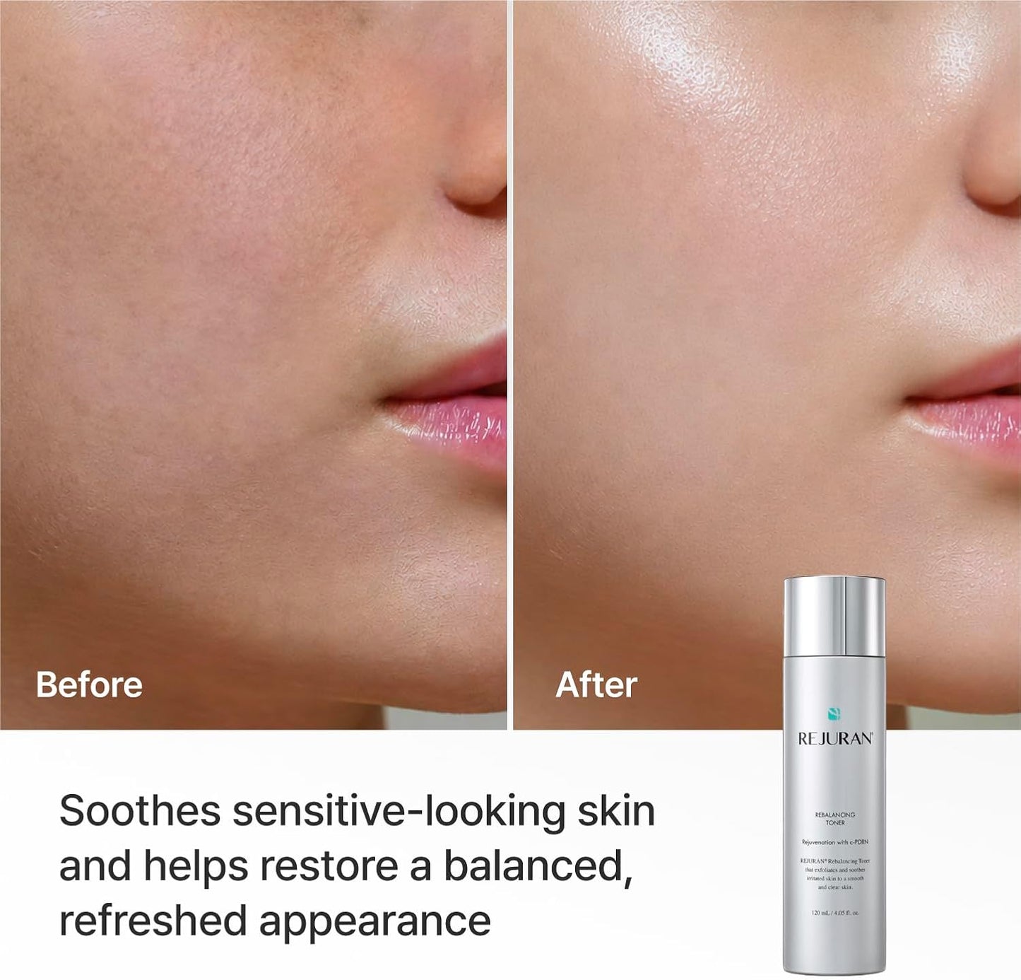 Rebalancing Toner – Εξισορροπητικό Toner Προσώπου με c-PDRN & PHA