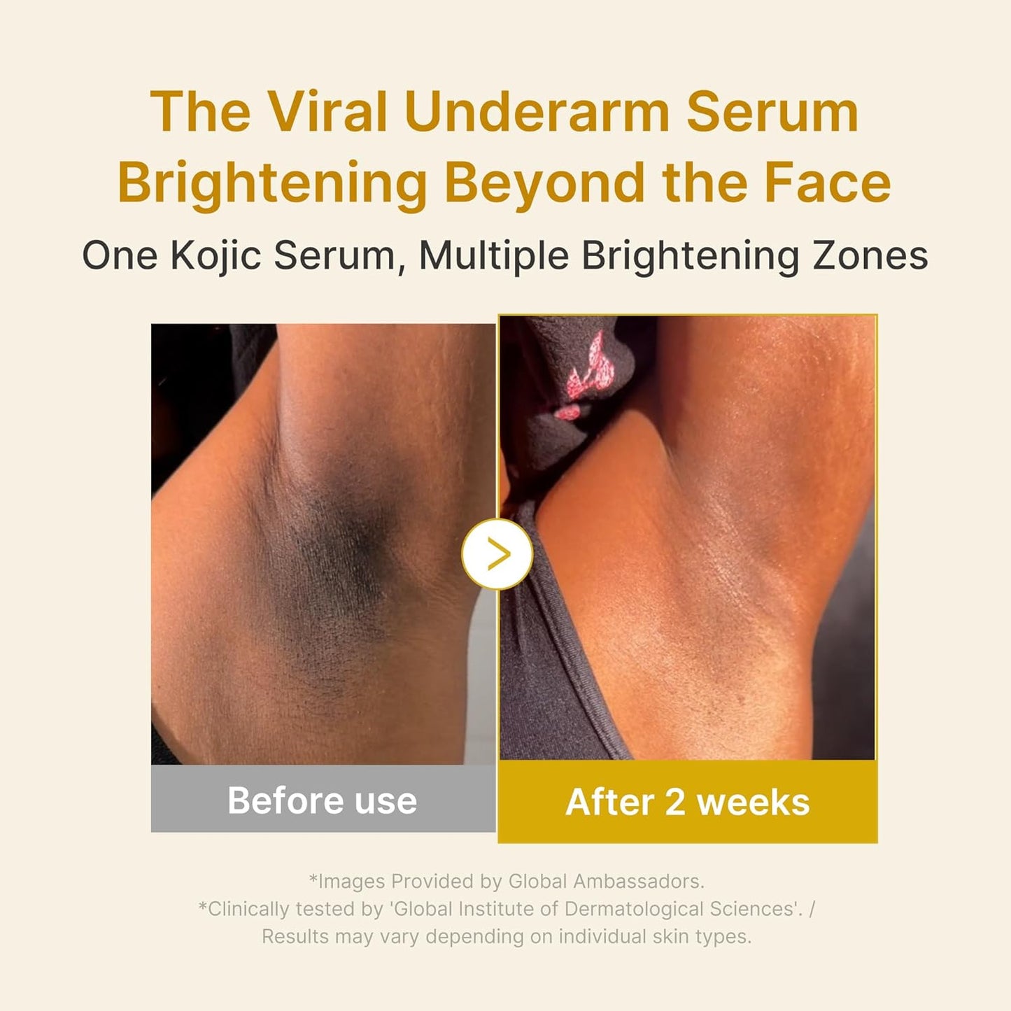 Kojic Acid Turmeric Niacinamide Serum - Ορός Προσώπου για Λάμψη, Ομοιόμορφο Τόνο και Ενυδάτωση