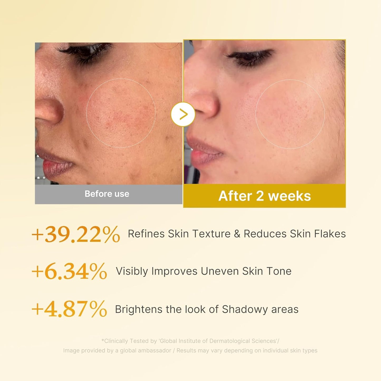 Kojic Acid Turmeric Resurfacing Toner – Τονωτική Λοσιόν Απολέπισης & Λάμψης για Δυσχρωμίες