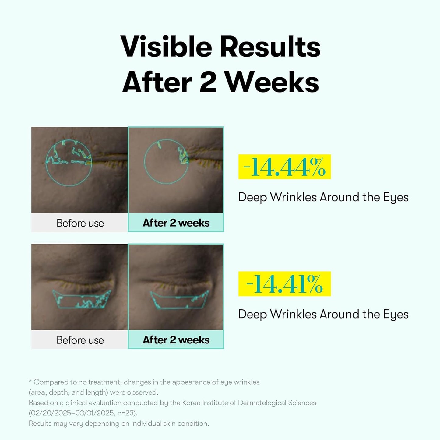 PDRN Reedle Shot Eye Lifter