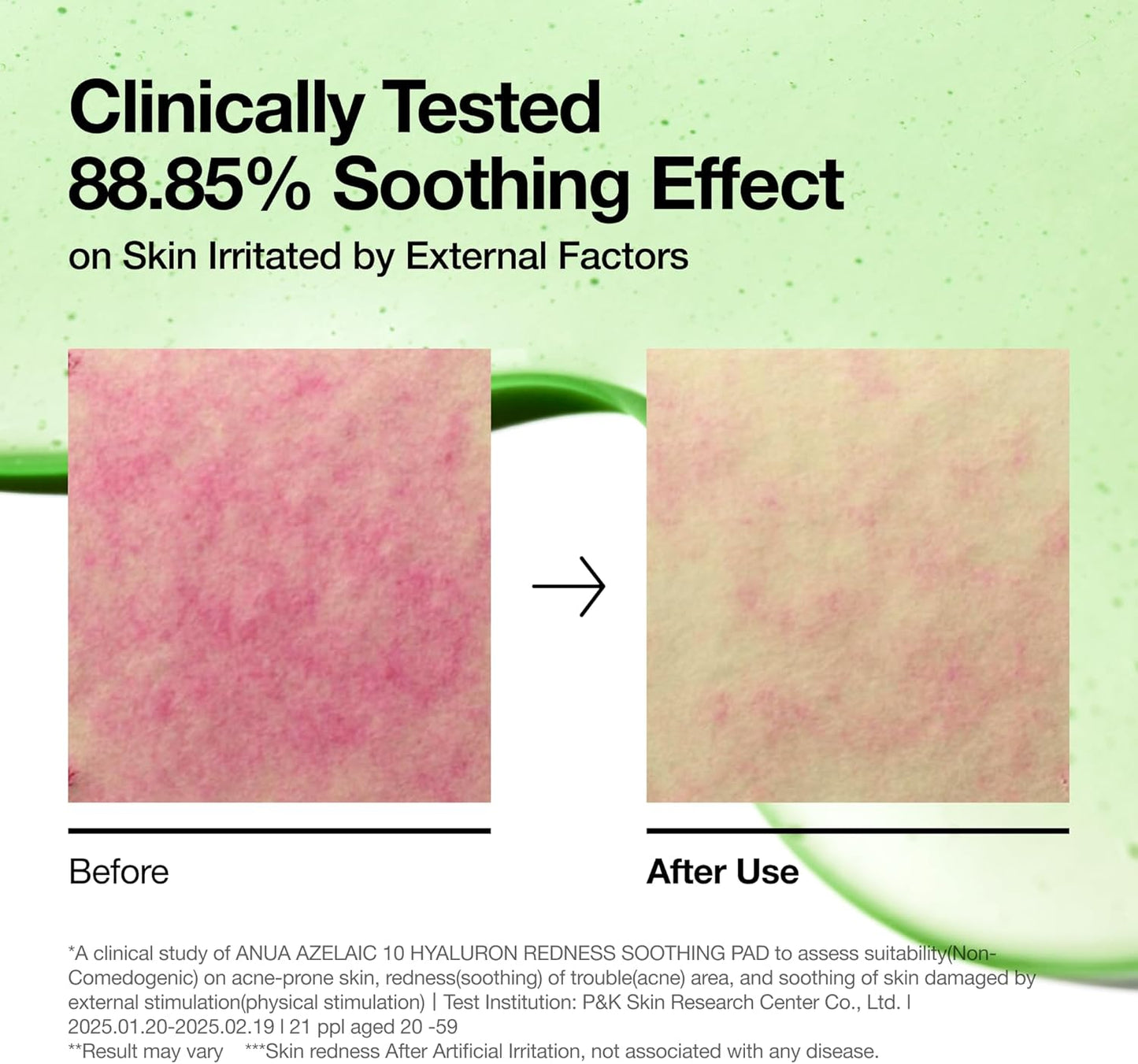 Azelaic 10 Hyaluron Redness Soothing Pad - Pads κατά της ερυθρότητας