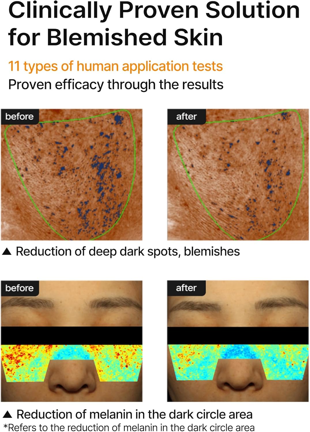 Pore+Dark Spot Brightening Cream - Κρέμα Λάμψης & Διόρθωσης Κηλίδων