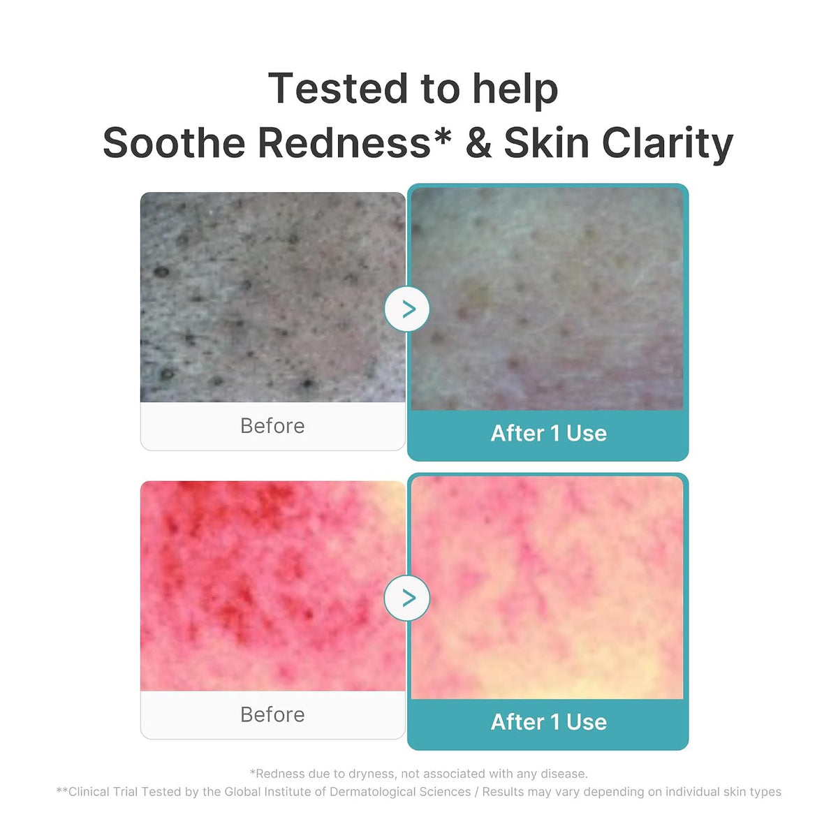 Azelaic Acid Niacinamide Deep Clean Foam Cleanser – Αφρός Βαθύ Καθαρισμού με Αζελαϊκό Οξύ & Νιασιναμίδη για Λιπαρότητα και Πόρους