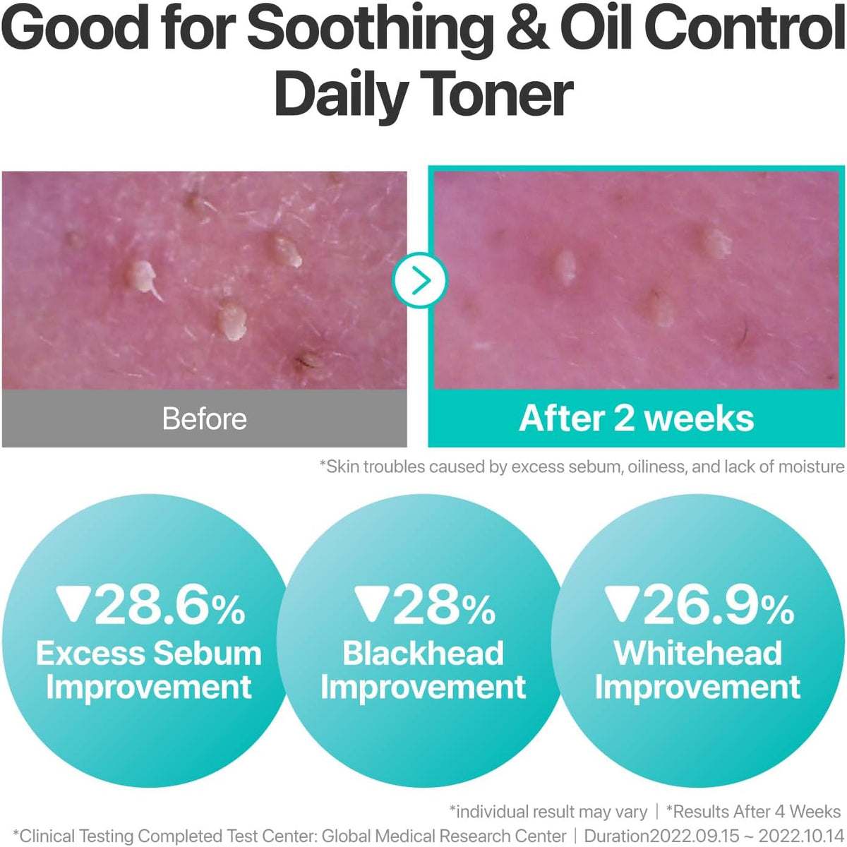 No.1 Pure-Full Calming Herb Toner 