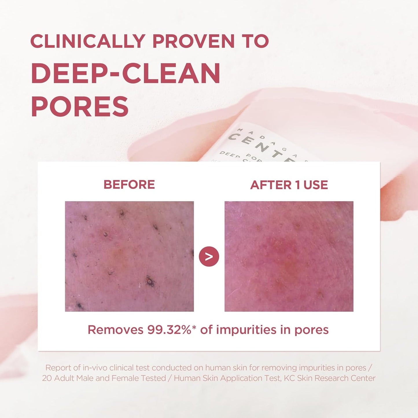 Madagascar Centella Poremizing Deep Cleansing Foam - Αφρός καθαρισμού για δέρμα με πόρους