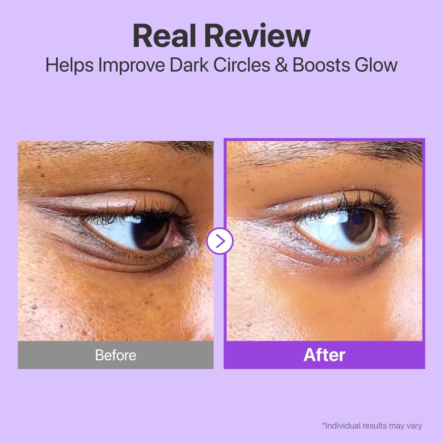 No.9 NAD Retinol Volumetox Eye Cream - Συσφιγκτική Κρέμα Ματιών με NAD+ & Ρετινόλη για Λεία, Ξεκούραστη Όψη