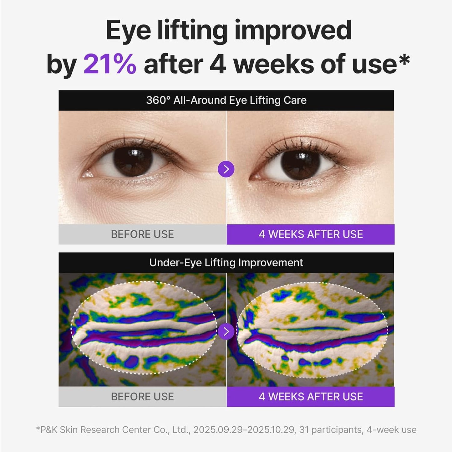 360º Shot PDRN Lifting Eye Cream – Συσφικτική Κρέμα Ματιών με PDRN, Ρετινόλη & Κολλαγόνο