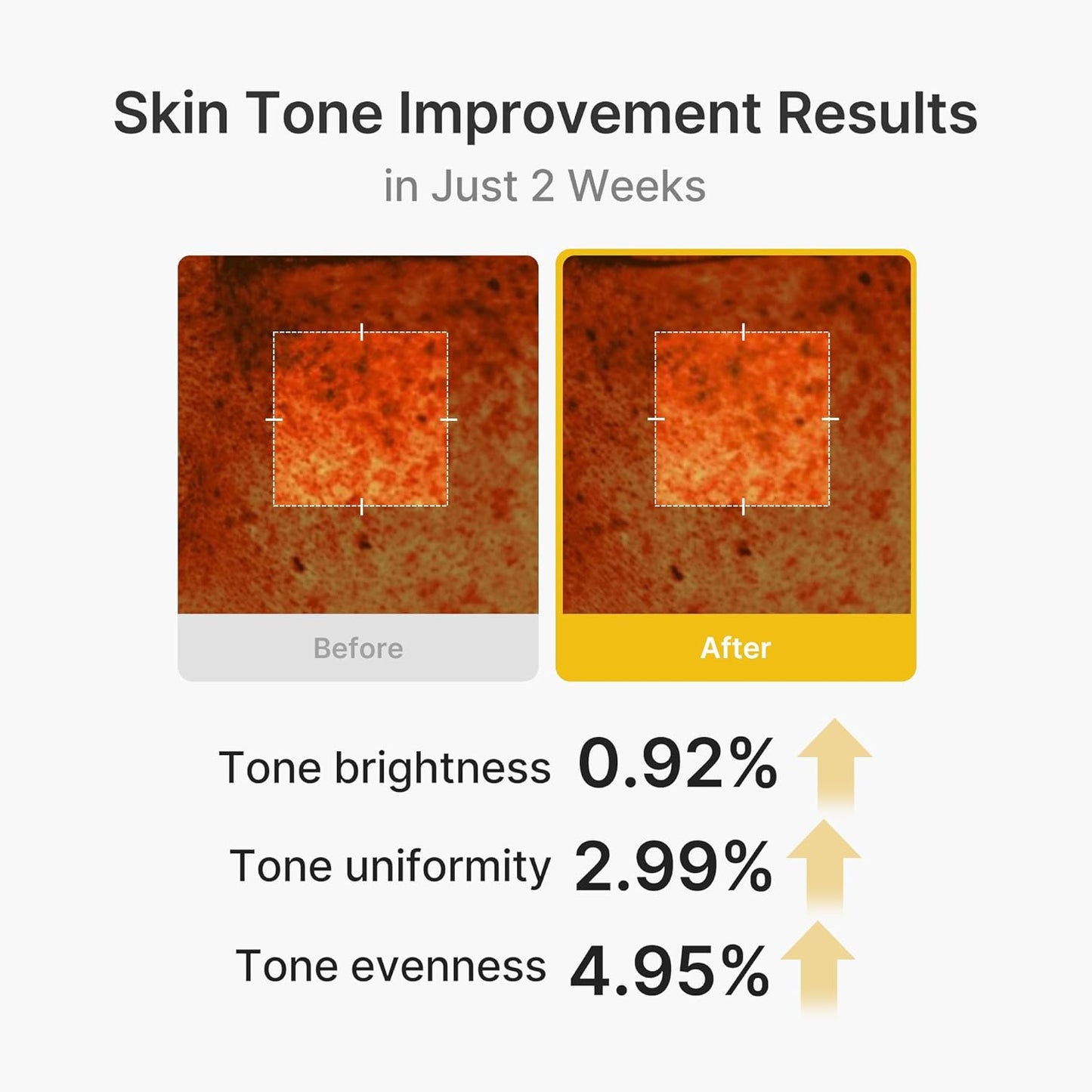 Kojic Acid Turmeric Vita Capsule Cream – Κρέμα Προσώπου με Kojic Acid, Κουρκουμά & Βιταμίνη C για Δυσχρωμίες και Λάμψη