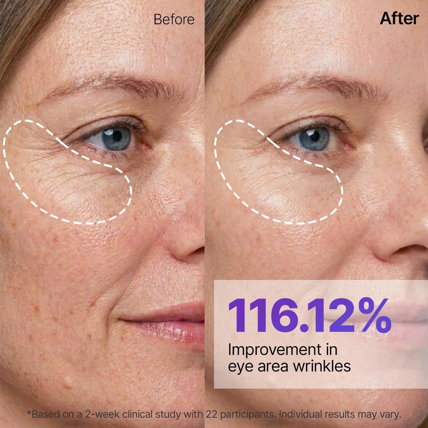 Silk Peptide EGF Gold Mask - Μάσκα Προσώπου Νυχτερινής Ανόρθωσης με 24Κ Χρυσό, Πεπτίδια & EGF