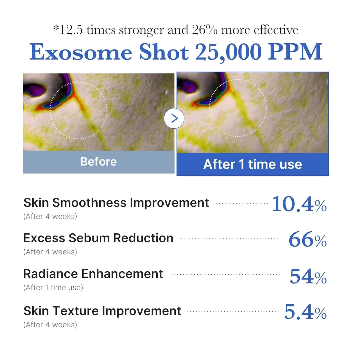 One Day Exosome Shot Pore Serum 25000 - Ορός micro-needling για λεία υφή & φωτεινό δέρμα