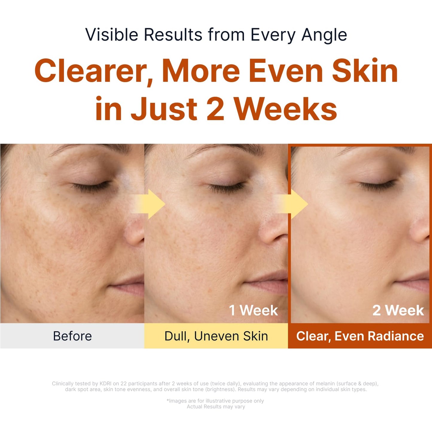 Kojic Acid Niacinamide Brightening Ampoule 40ml – Αμπούλα Λάμψης & Κατά των Κηλίδων με Kojic Acid