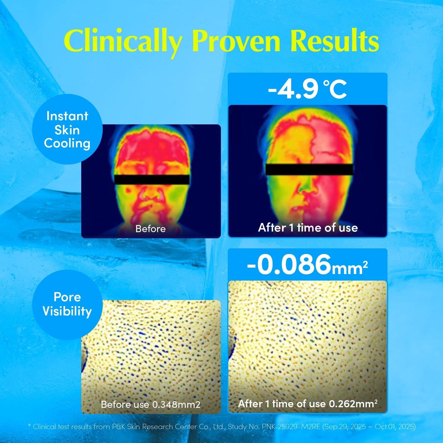 Hyaltoin Flooding Toner – Ενυδατική Τονωτική Λοσιόν Βαθιάς Ενυδάτωσης & Cooling Effect