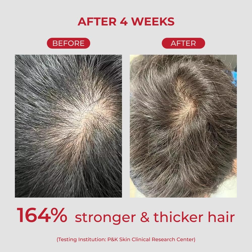 Annurcatin Shampoo – Σαμπουάν Ενδυνάμωσης & Όγκου για Αδύναμα Μαλλιά