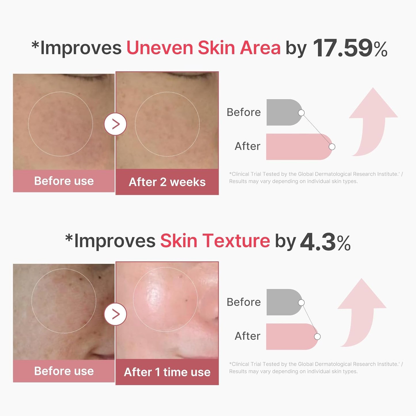 PDRN Pink Exosome Shot Serum 2000 - Ορός micro-needling για ατέλειες, δυσχρωμίες & ανομοιόμορφη υφή