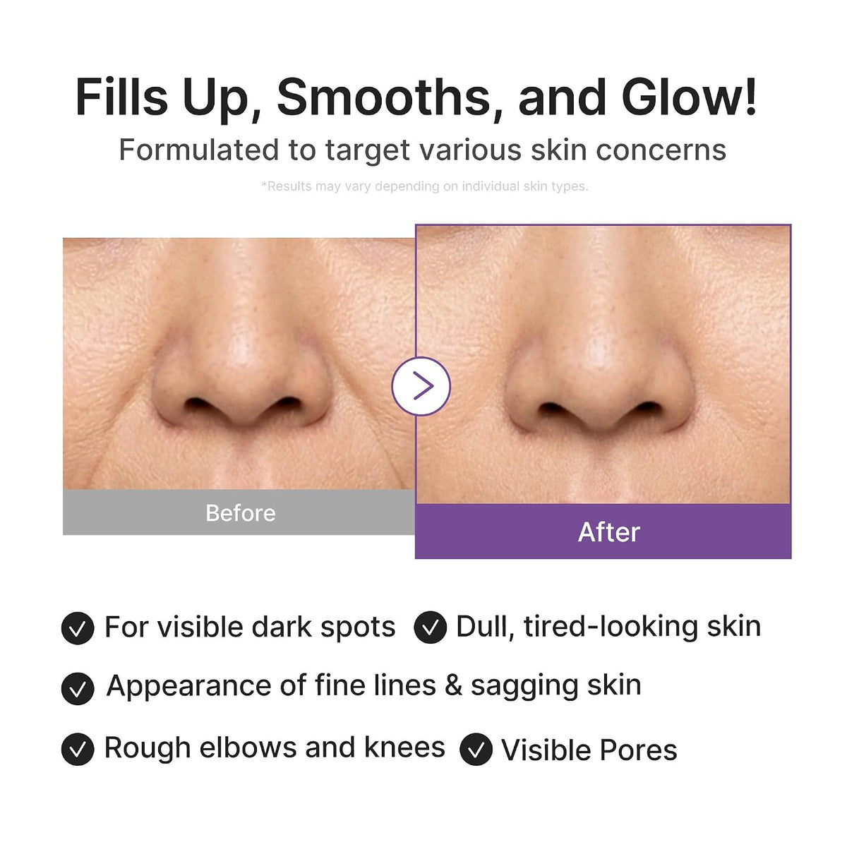 Retinol NMN Boosting Serum – Συσφικτικός Ορός Ρετινόλης για Πόρους & Λεπτές Γραμμές