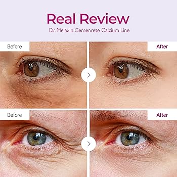 Cemenrete Calcium Volume Eye Patch - Ενισχυτικά patches με ασβέστιο & κολλαγόνο