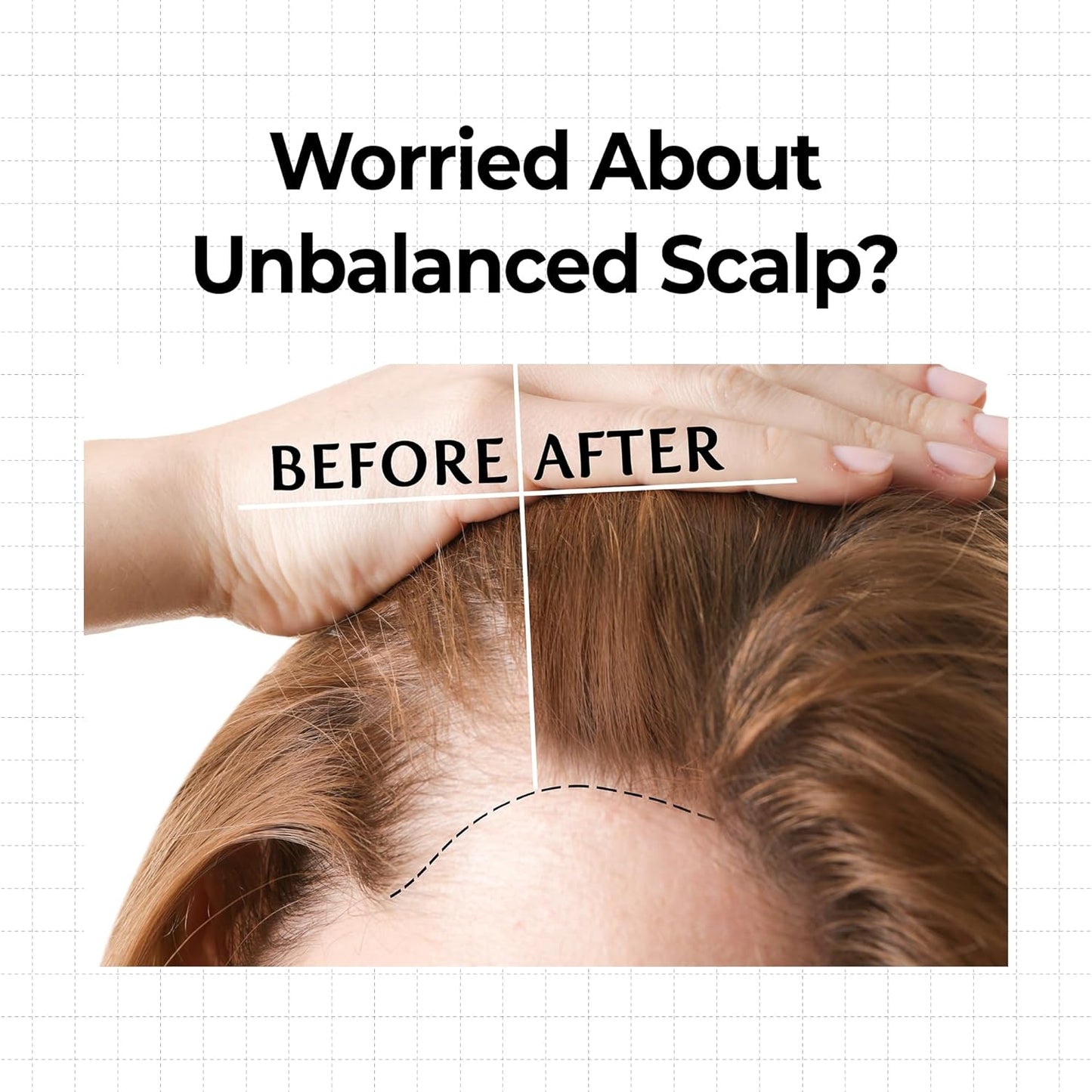 10X Caffeine Strengthening Scalp Serum