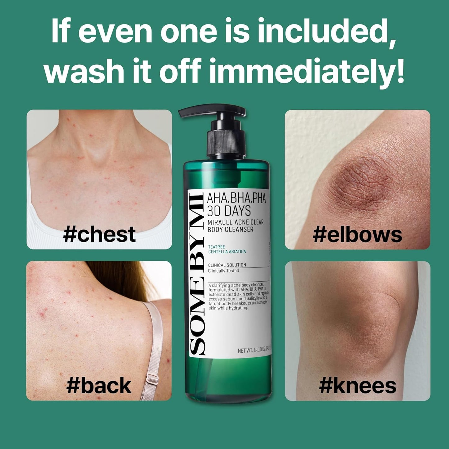 AHA-BHA-PHA 30 days Miracle Acne Body Cleanser 