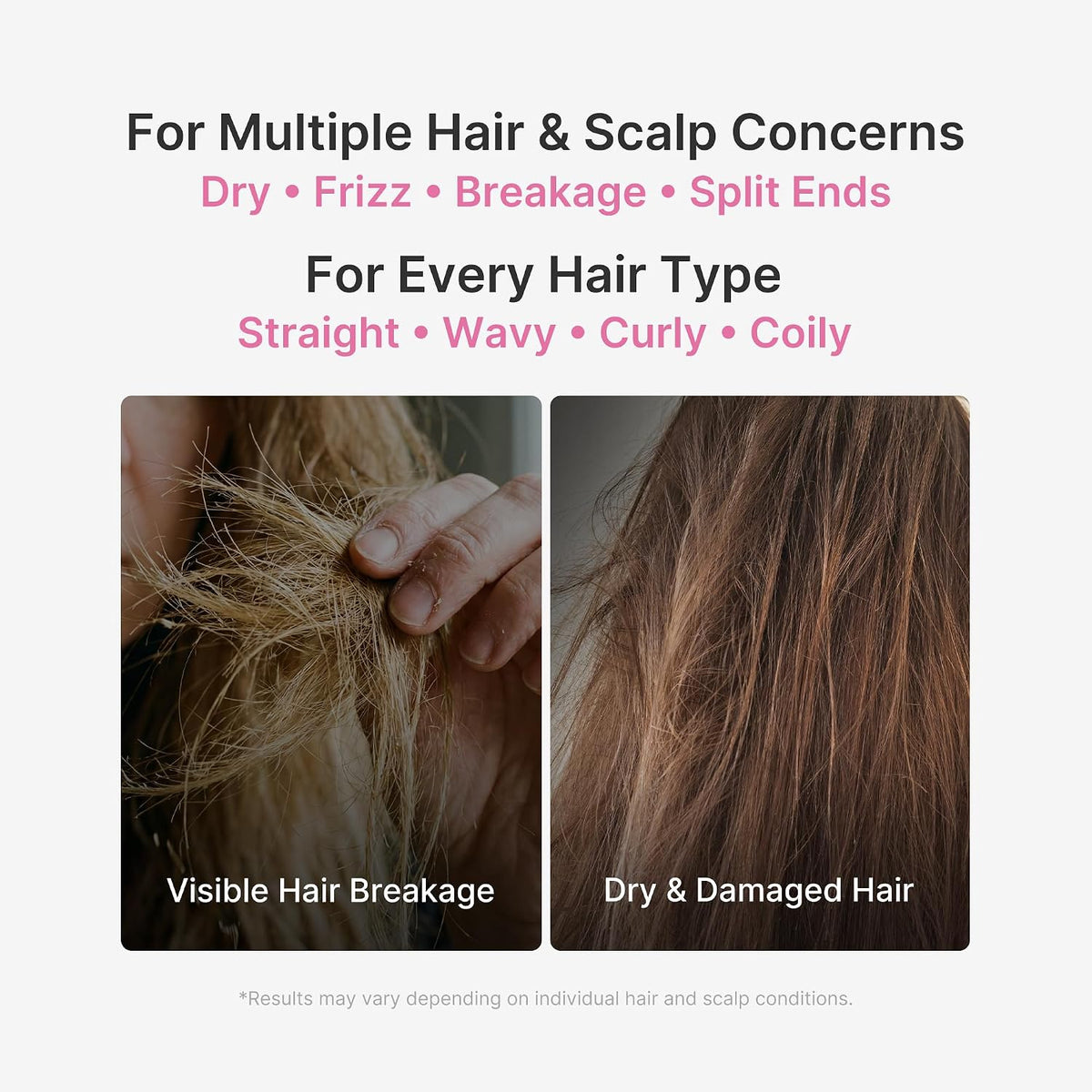 Rosemary PDRN Hair & Scalp Conditioner – Conditioner Μαλλιών & Τριχωτού για Ενυδάτωση, Δύναμη & Όγκο με Δενδρολίβανο & PDRN