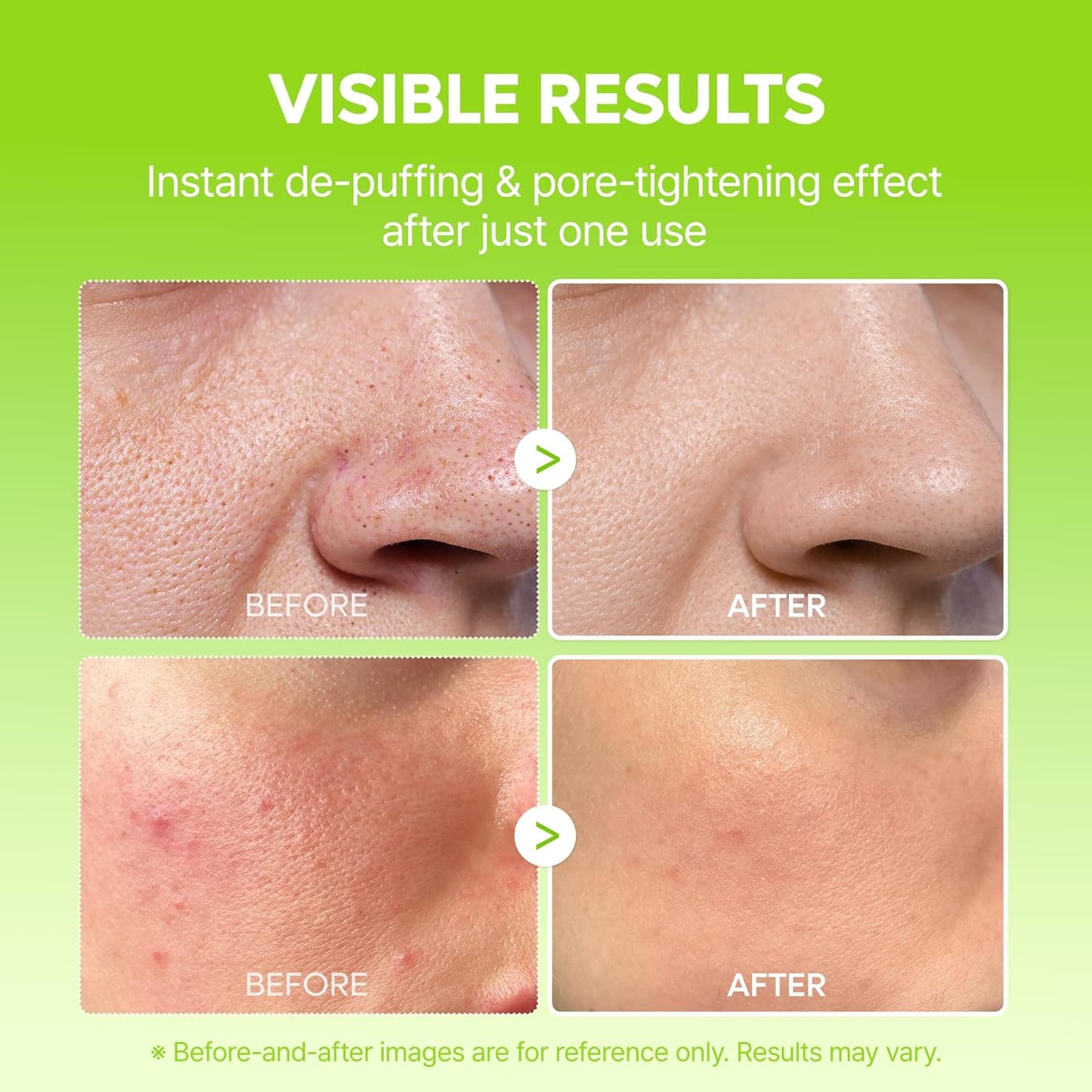 Cactox Pore Relief Jelly Serum Mist - Δροσιστικό Serum Mist με Κάκτο για Σύσφιξη Πόρων & Άμεση Ενυδάτωση