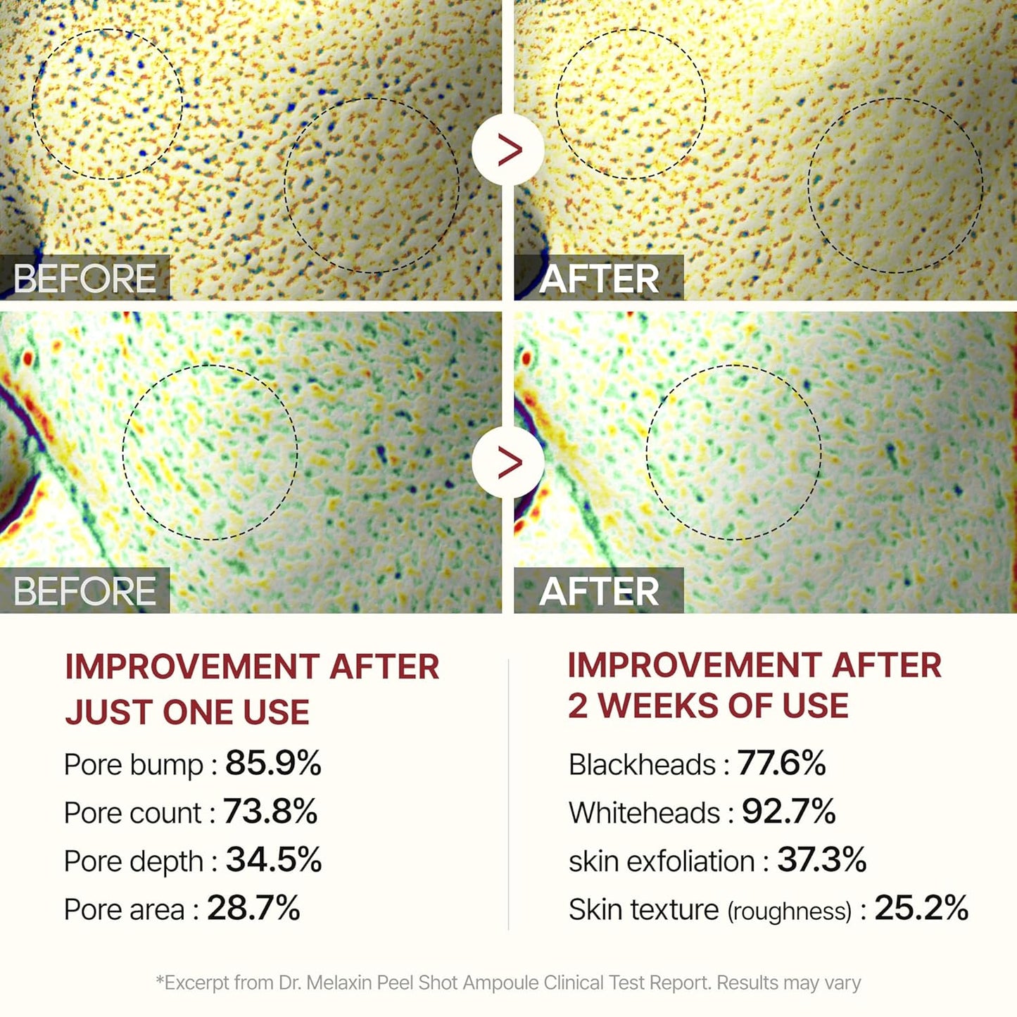 Peel Shot Exfoliant White Rice Ampoule - Απολεπιστική Αμπούλα για Λάμψη & Λεία Επιδερμίδα